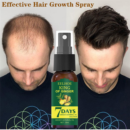 30 ml Hair Growth Essence Germinal Serum Essence Oil Natural Hair Loss Treatement Effective Fast Growth Scalp Treatment  Men Women